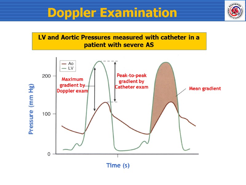Doppler Examination   Time (s) Pressure (mm Hg) Maximum gradient by Doppler exam